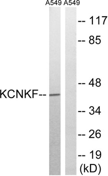 TASK-5 rabbit pAb