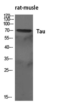 Tau antibody