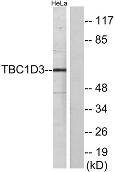 TBC1D3A/B/C rabbit pAb