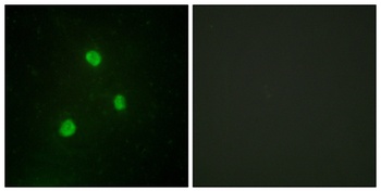 TBX1 antibody