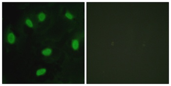 TBX15/18 antibody