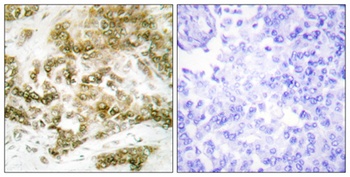 TBX15/18 antibody