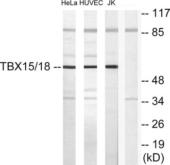 TBX15/18 antibody