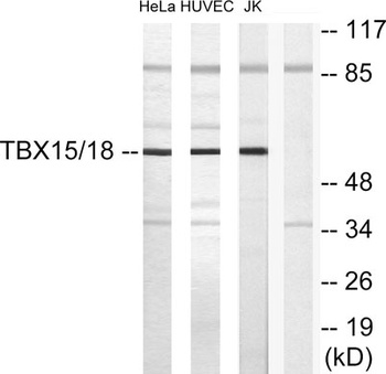 TBX15/18 rabbit pAb