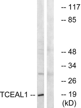 TCEAL1 rabbit pAb