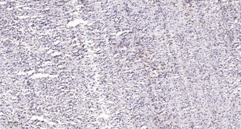 TCF-1 antibody