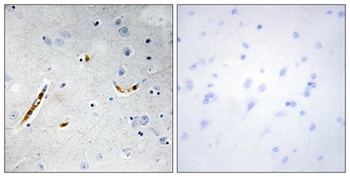 TCF-3 antibody