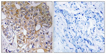 TCP-1 ζ rabbit pAb