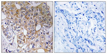 TCP-1 zeta antibody