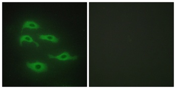 TDE1 antibody