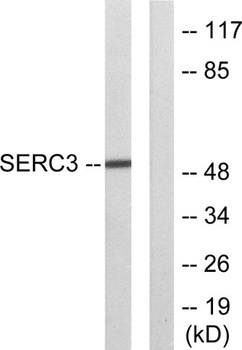 TDE1 antibody