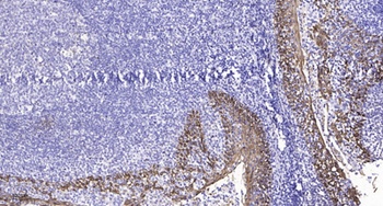 TDE1 antibody