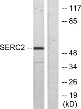 TDE2L antibody