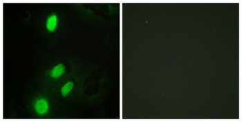 TEL antibody