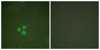 TFDP1 rabbit pAb