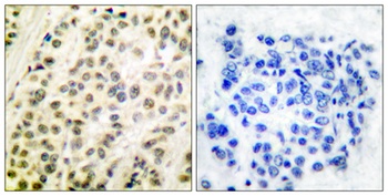 TFDP1 rabbit pAb