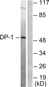 TFDP1 rabbit pAb