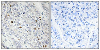 TFIID rabbit pAb Antibody