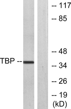 TFIID antibody