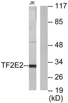 TFIIE-beta antibody