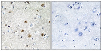 TFIIIB90-1 antibody