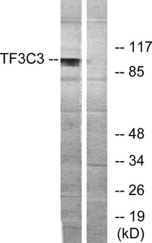 TFIIIC102 rabbit pAb Antibody