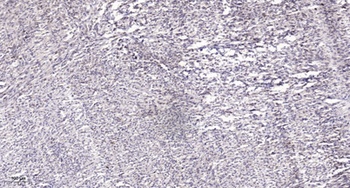 TFIIIC110 rabbit pAb