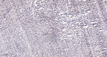 TFIIIC110 antibody