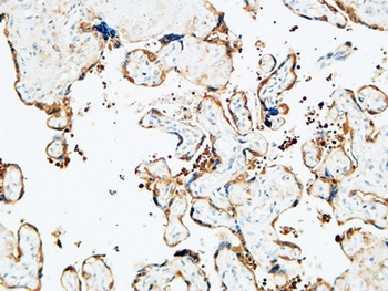 TGase2 antibody