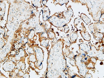 TGase2 antibody