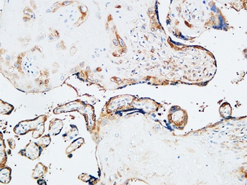 TGase2 antibody