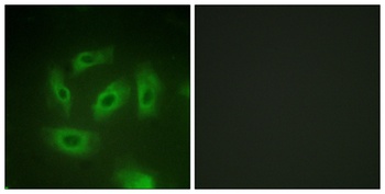 TGF beta RI antibody