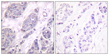 TGF Beta 3 antibody