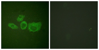 TH antibody