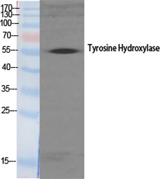 TH antibody