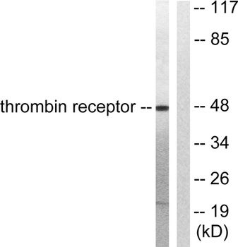 Thrombin R antibody