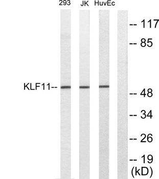 TIEG2 antibody