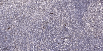 TIEG2 rabbit pAb