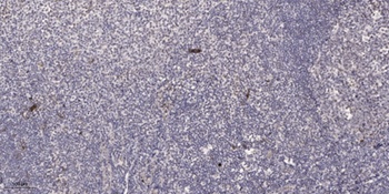 TIEG2 antibody