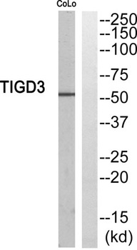 TIGD3 antibody