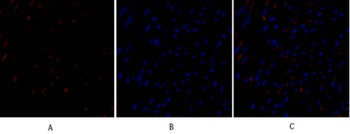 TIMP-1 antibody