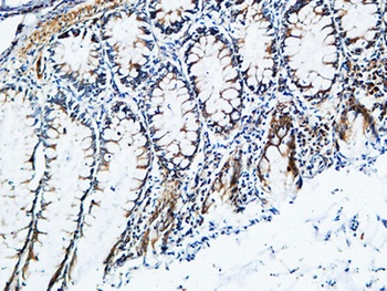 TIMP-2 antibody