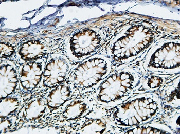 TIMP-2 antibody