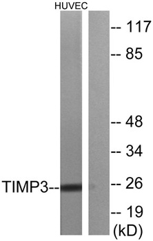 TIMP-3 rabbit pAb