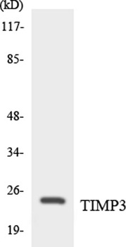 TIMP-3 antibody