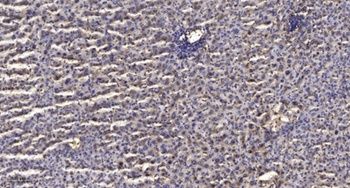 TIMP-3 antibody