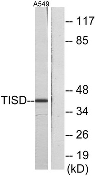 TIS11D antibody