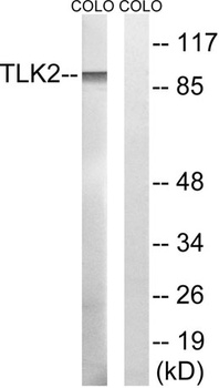 TLK2 rabbit pAb