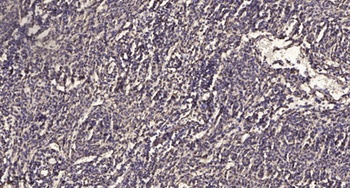 TLK2 rabbit pAb