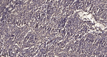 TLK2 antibody